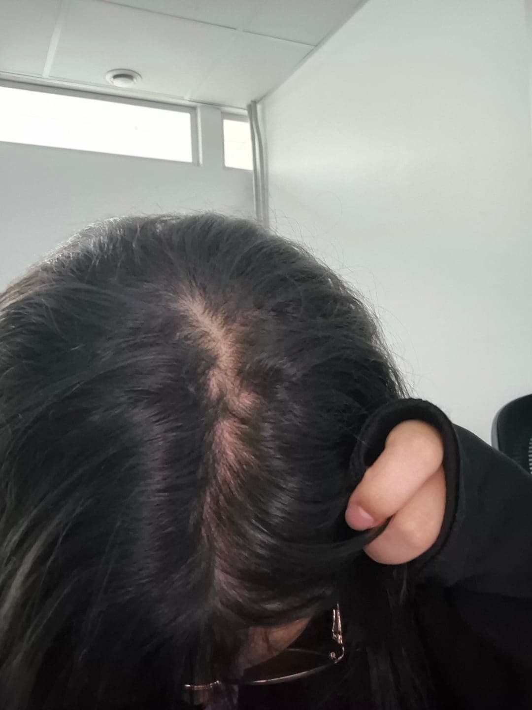 Foto de Alejandra M. usando Shampoo Anticaída Jaborandi 300ml