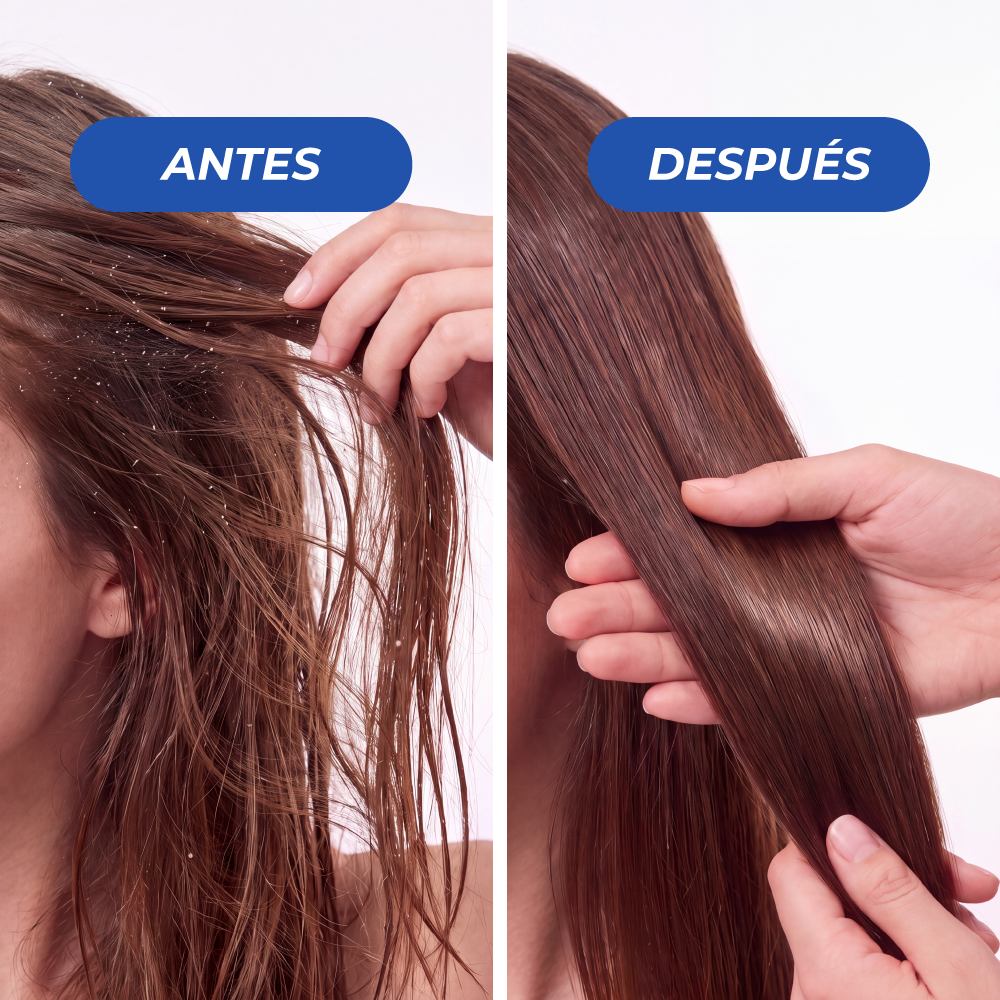 Shampoo Anticaspa ICE 4 Luxeny